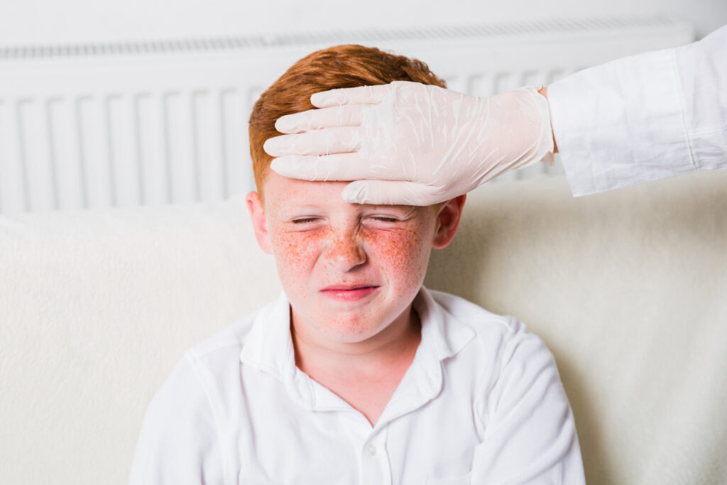 How Stevens Johnson Syndrome Is Diagnosed