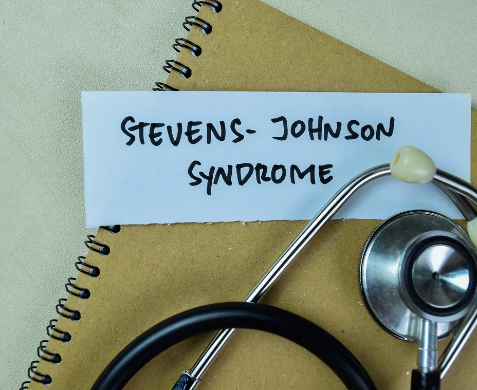 stevens johnson syndrome with notepad and stethoscope