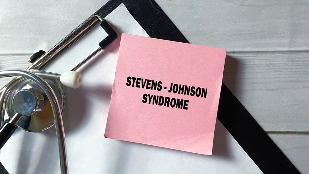 Stevens-Johnson Syndrome is written on a sticky note