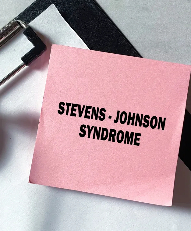 Stevens-Johnson Syndrome note symbolizing medical documentation of the condition Pink sticky note on a clipboard labeled “Stevens-Johnson Syndrome,” representing awareness of the condition